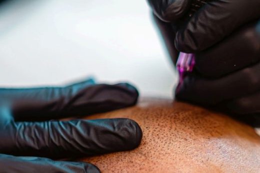 Effet crâne rasé à Monaco avec la tricopigmentation capillaire