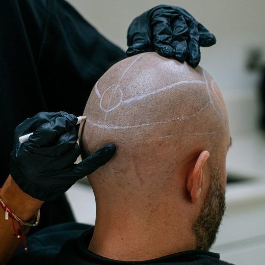 Tatouage capillaire à Nice : l’art de la précision signée TP Lab