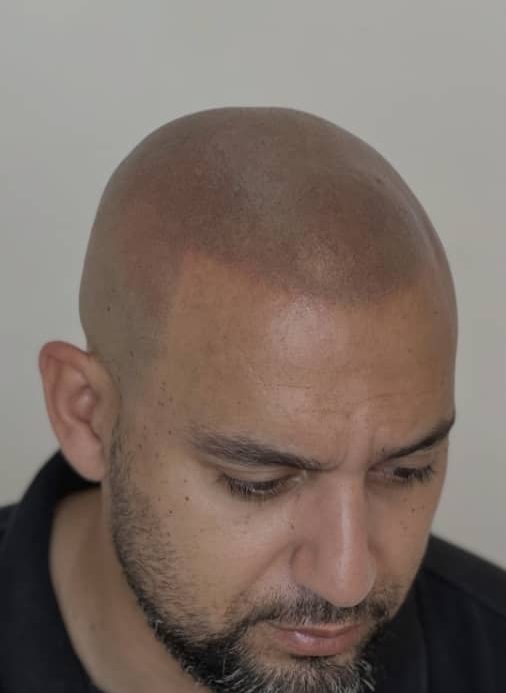 Redonner confiance,Révéler votre image